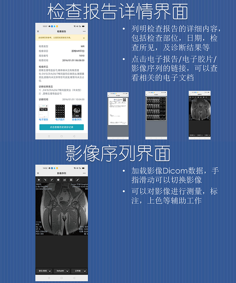 醫(yī)院放射透視檢測報告電子膠片檢查報告云管理系統(tǒng)軟件開發(fā)APP小程序定制 醫(yī)院放射透視檢測報告電子膠片檢查報告云管理系統(tǒng)軟件開發(fā)APP小程序定制